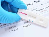 Экспресс-тесты на коронавирус!